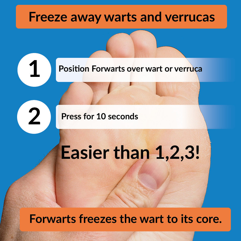 Forwarts Wart & Verruca Remover